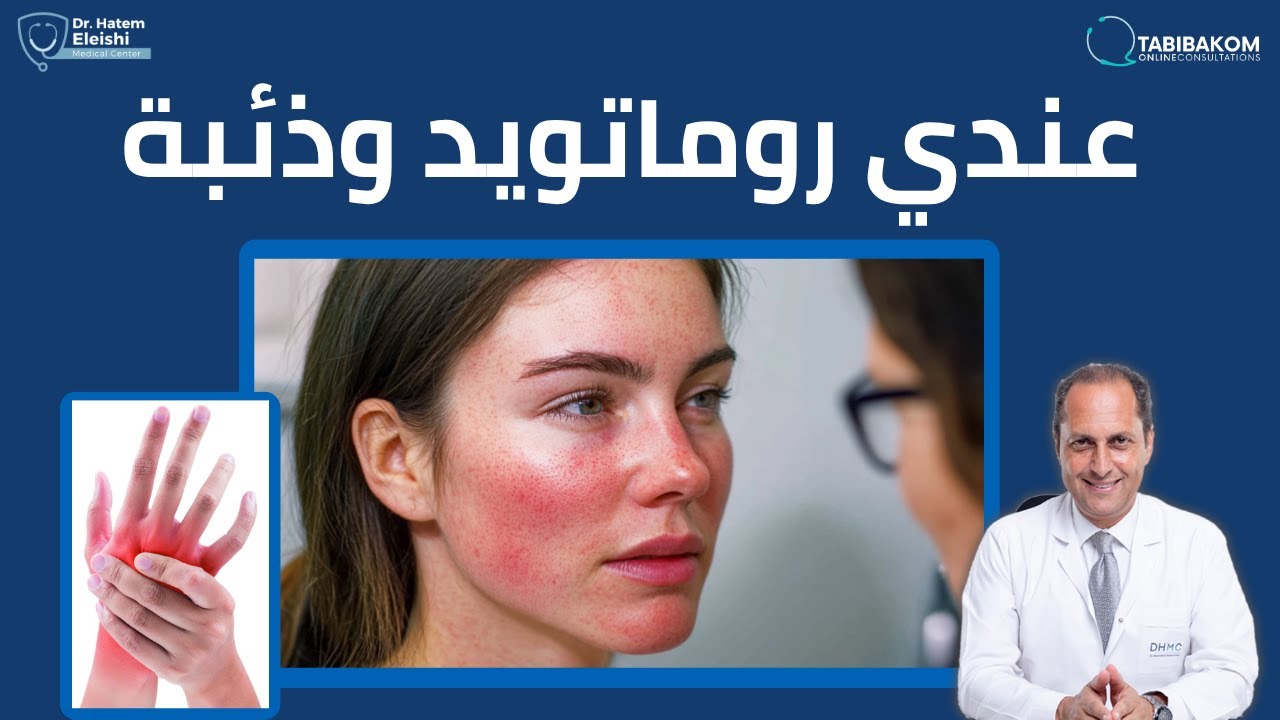 عندي روماتويد وذئبة. أ.د. حاتم العيشي