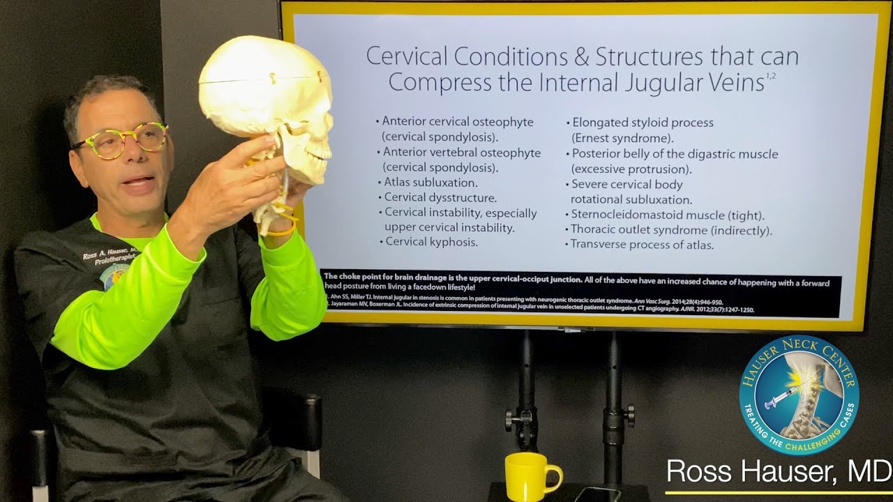 Internal Jugular Vein Compression and Intracranial Hypertension - Symptoms, Causes, & Testing