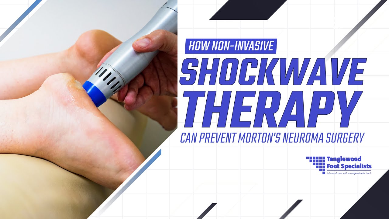 How Non Invasive Shockwave Therapy Can Prevent Morton's Neuroma Surgery