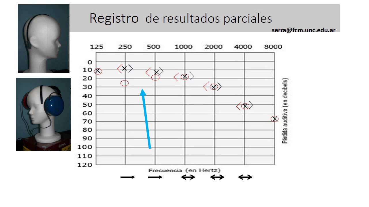 FONOAUDIOLOGIA