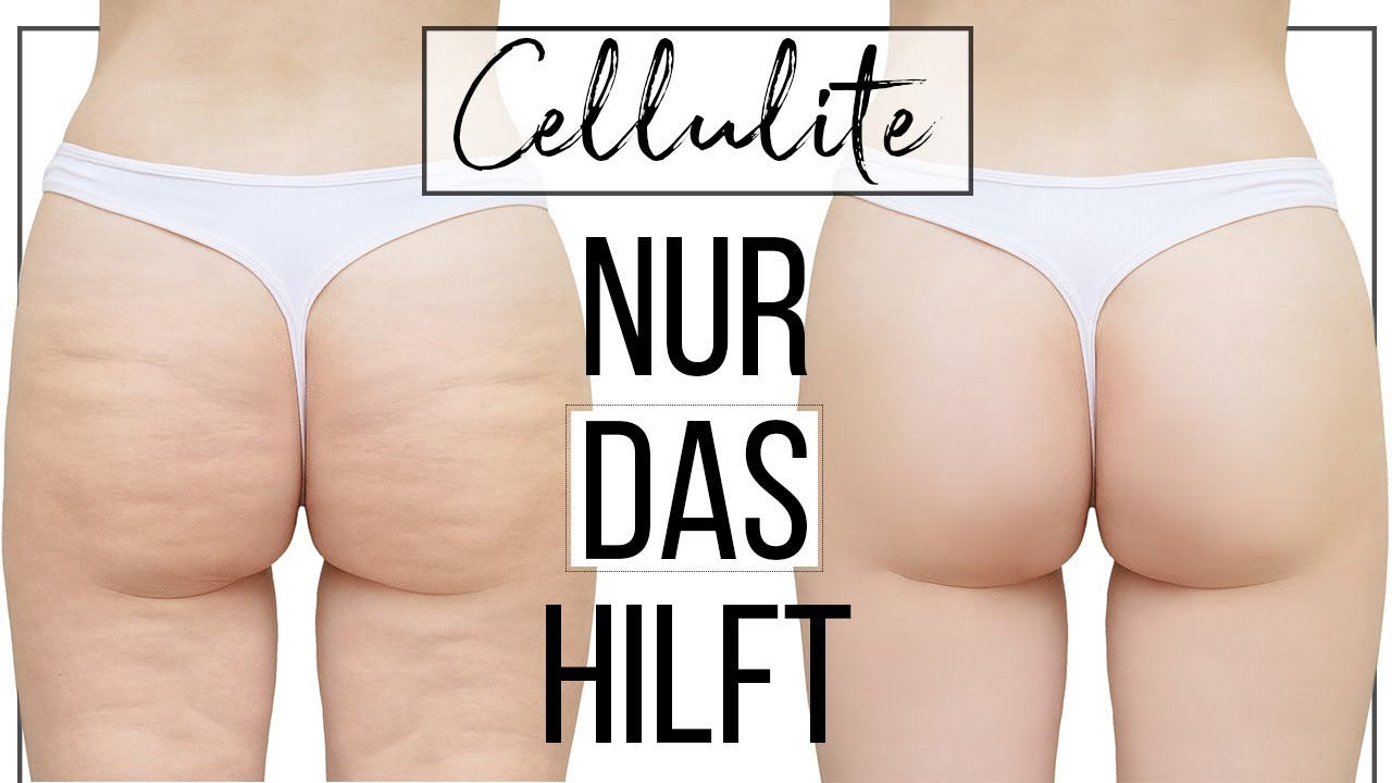 Cellulite bek&auml;mpfen - SO klappt es❗