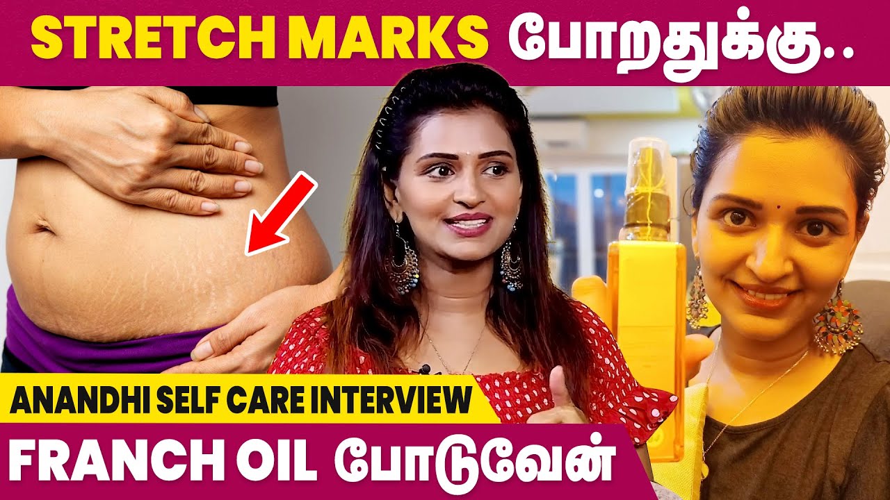 Actress Anandhi Interview | Dark Circle Remedies at Home