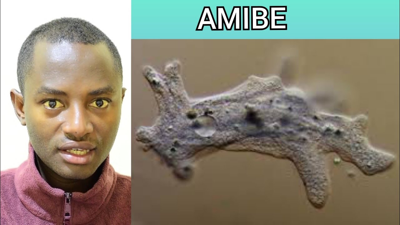Ibimenyetso n'imiti ya AMIBE. Burya igera mu mwijima,ubwonko no mpyiko.