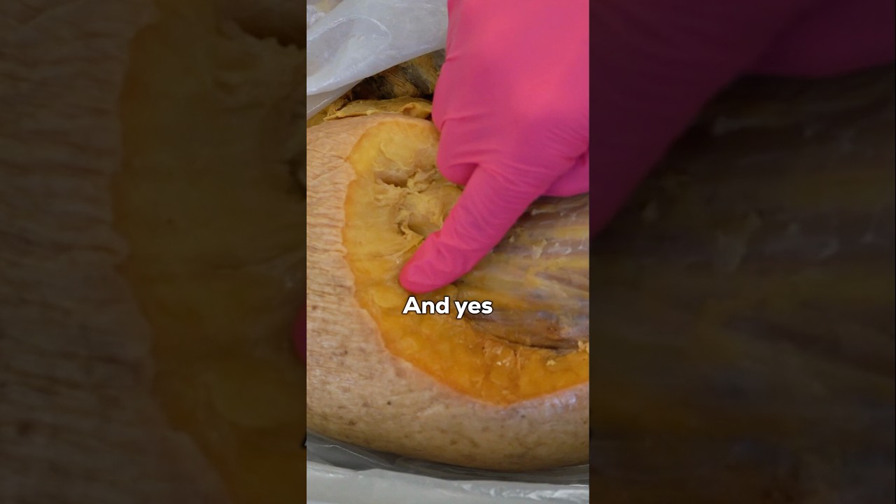 The Different Types of Fat