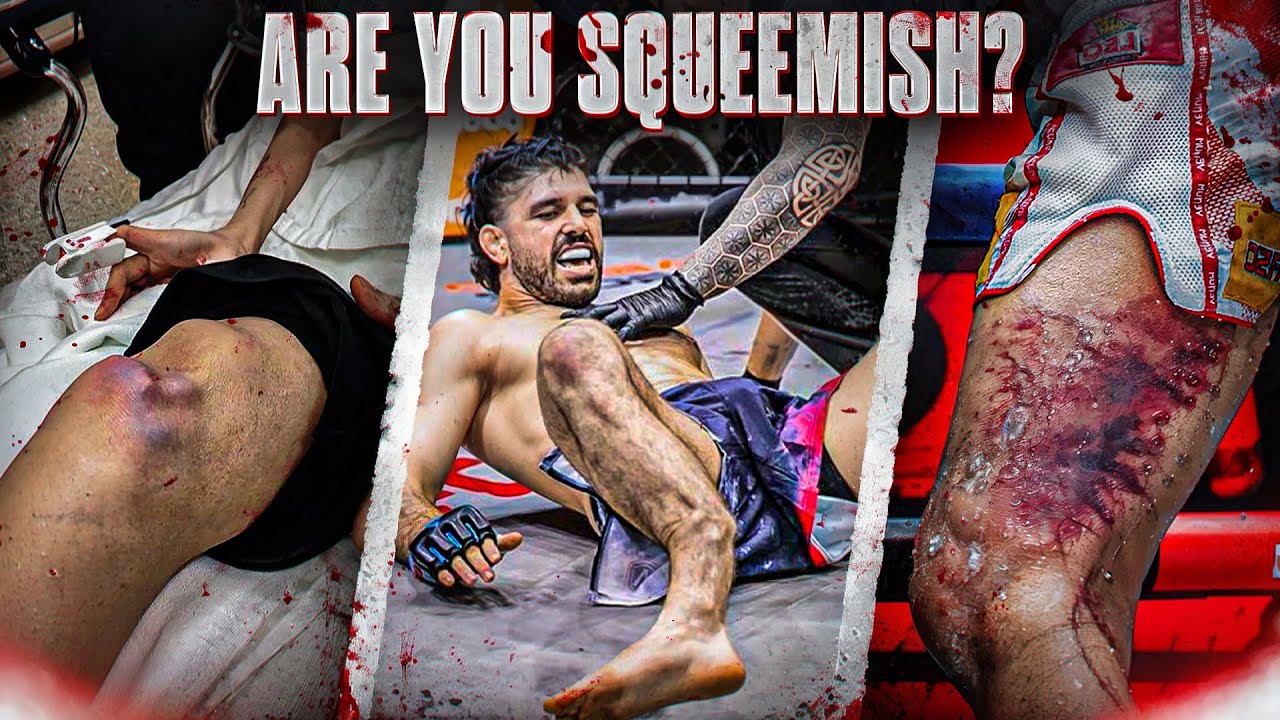 The Worst Leg Kicks Of All Time 😳