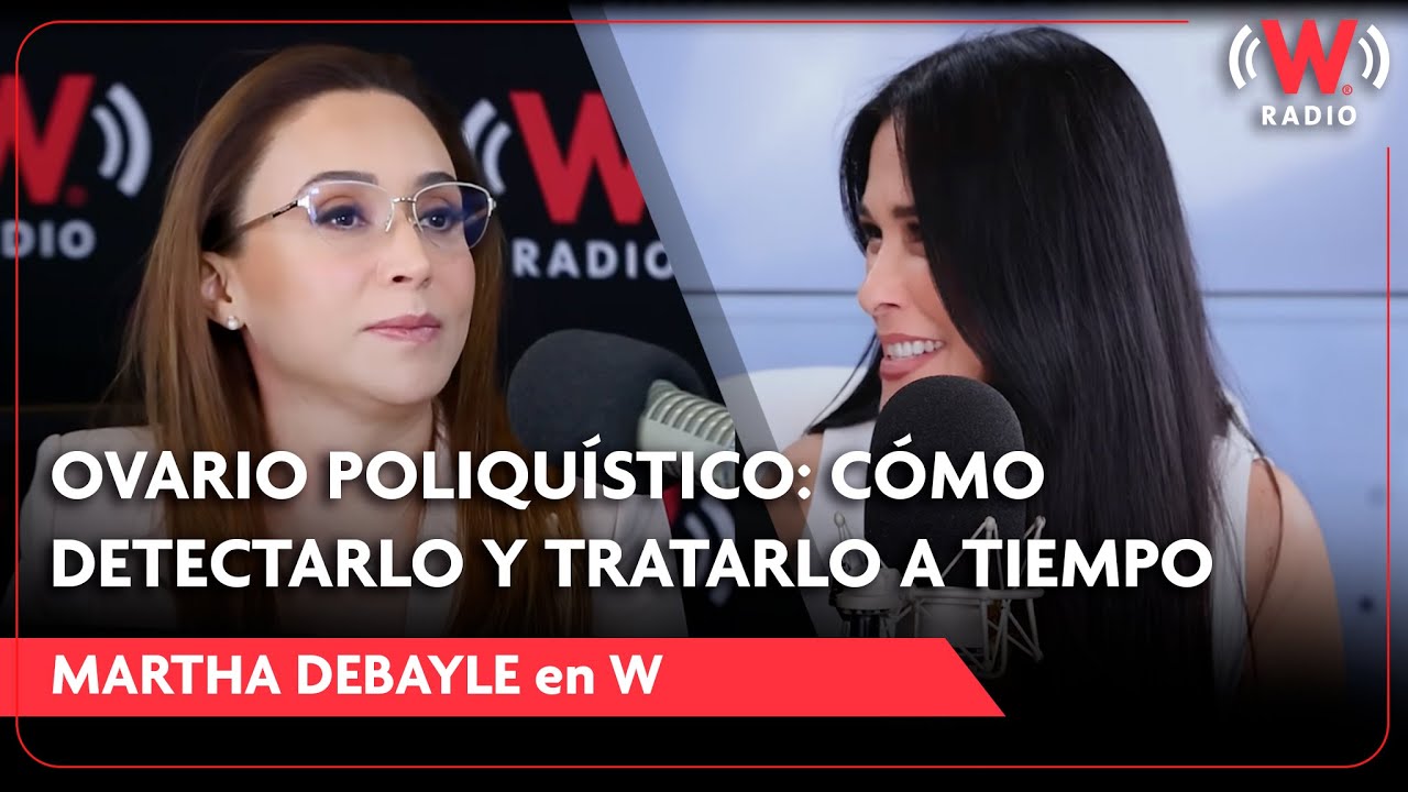 Ovario poliquístico: cómo detectarlo y tratarlo a tiempo | Isela Méndez en Martha Debayle en W