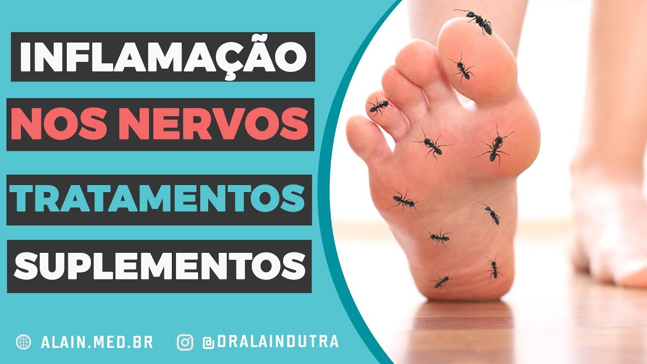 Inflamação nos nervos - Conheça a neuropatia periférica e como tratar - dr alain dutra