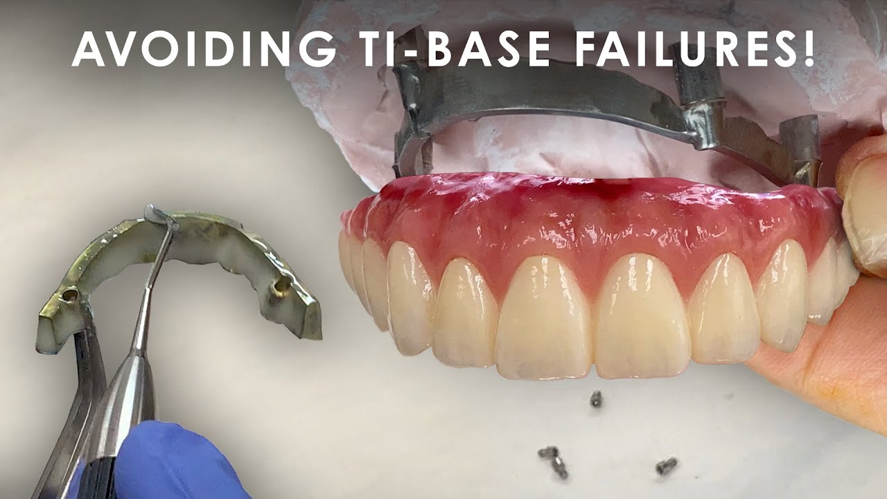 Как избежать сбоев Ti-Base