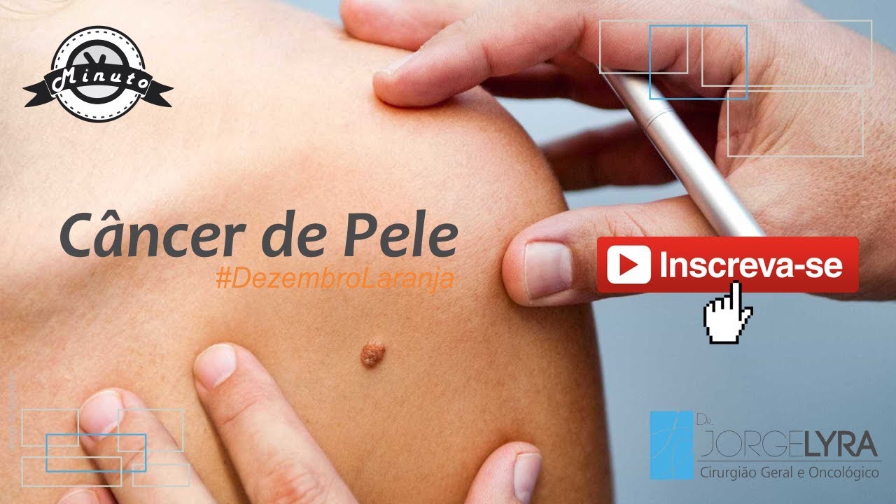 Dezembro Laranja - Campanha de Preven&ccedil;&atilde;o ao C&acirc;ncer de Pele