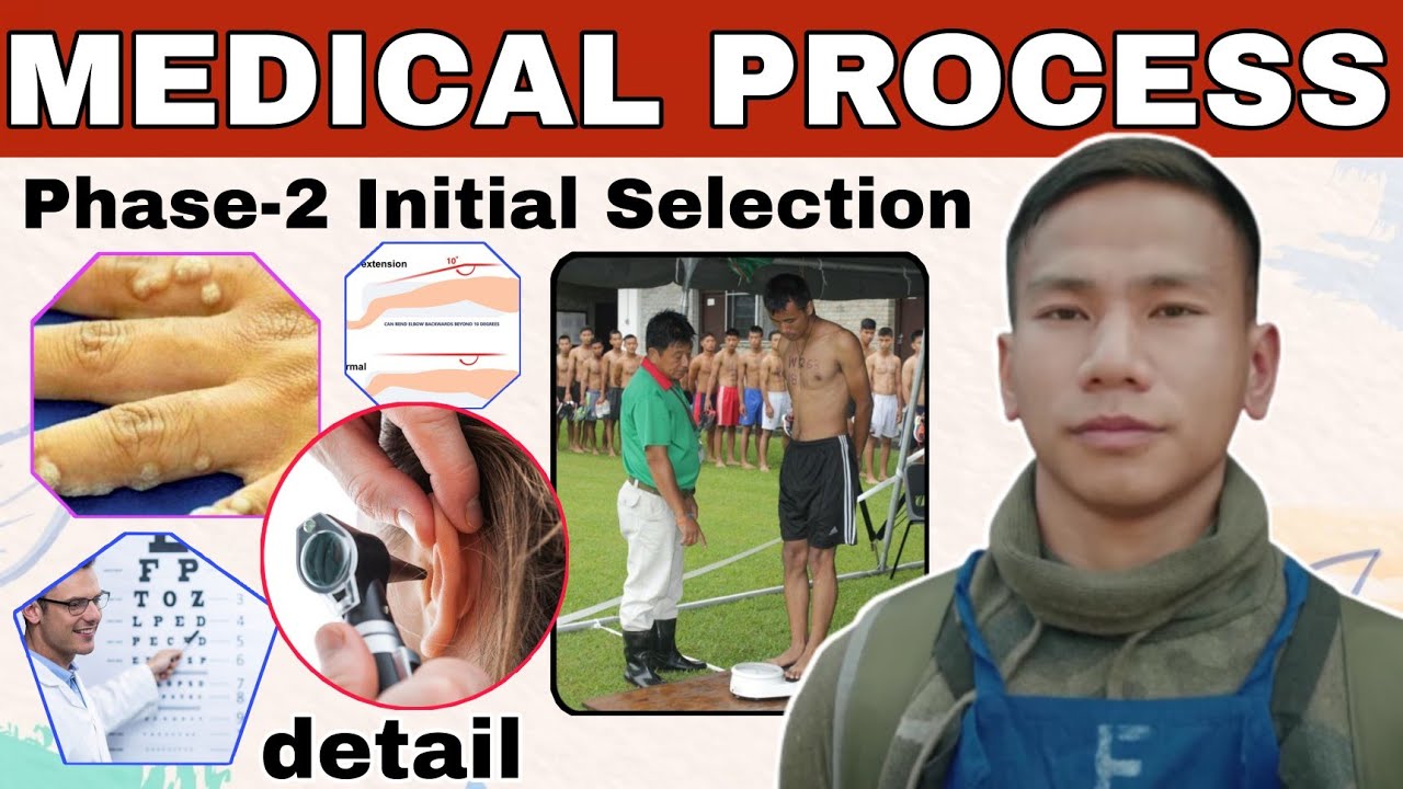 Phase 2 Medical Detail // Initial Selection // Gorkhali // British Gurkha Nepal