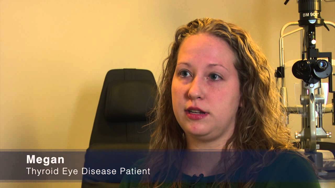 Thyroid Eye Disease Patient Experience with Dr. Raymond Douglas