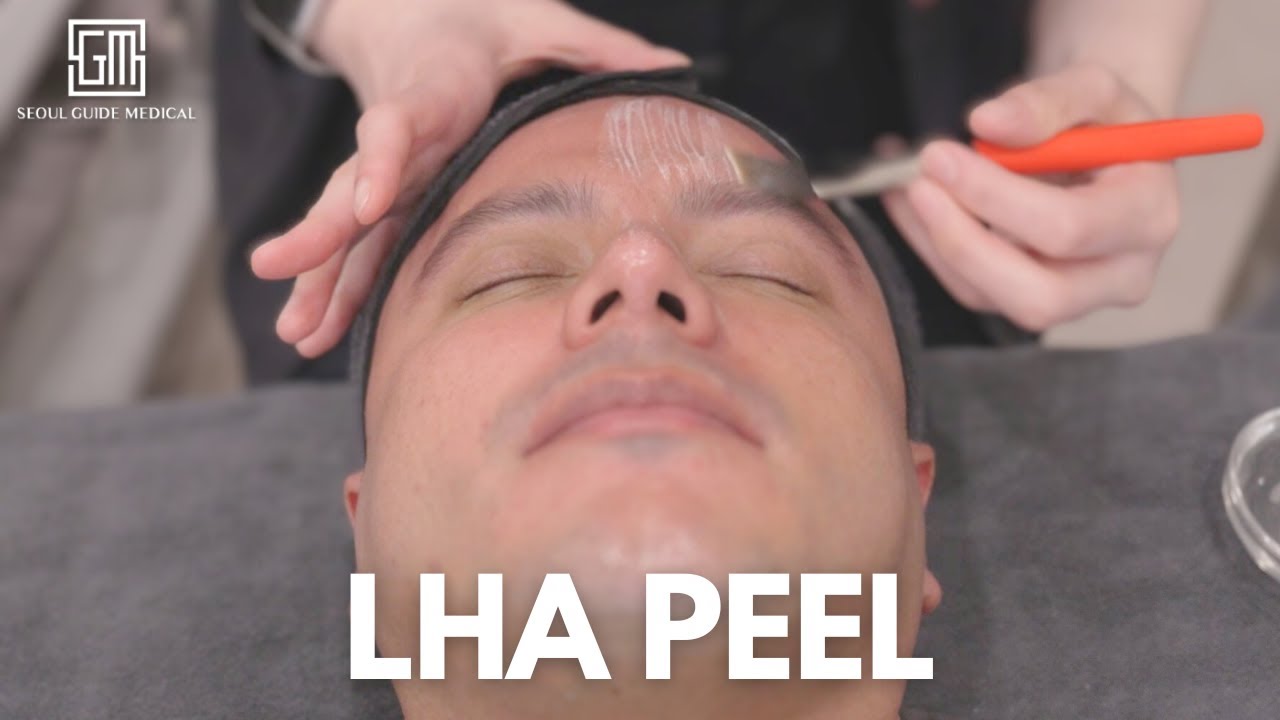 Transform Your Skin with LHA Peel &ndash; The Secret to a Clear & Radiant Complexion!