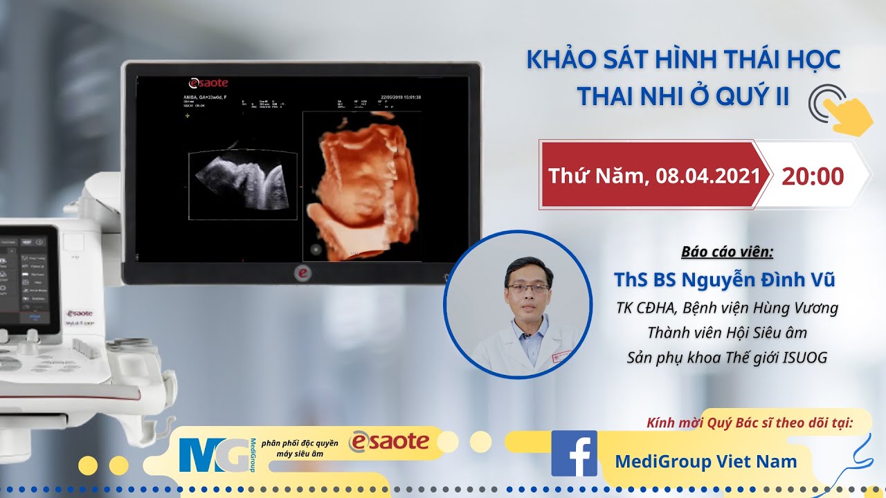 MediGroup I Khảo sát hình thái học thai nhi quý II - Th BSCK2 Nguyễn Đình Vũ - Bệnh viện Hùng Vương