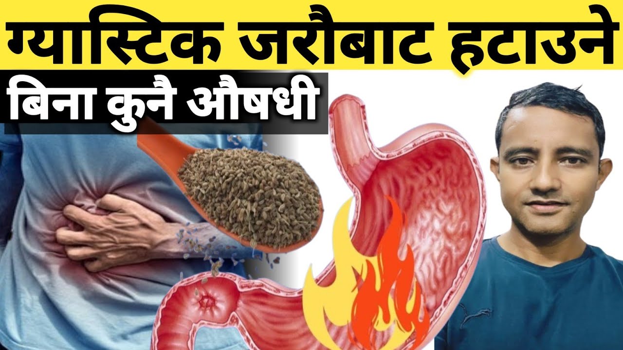 ग्यास्टिकको औषधिहरू खाई राख्दा पनि एसिडिटी र गैस कम नभए यो try गर्नु |Fix Acidity & Gas Naturally