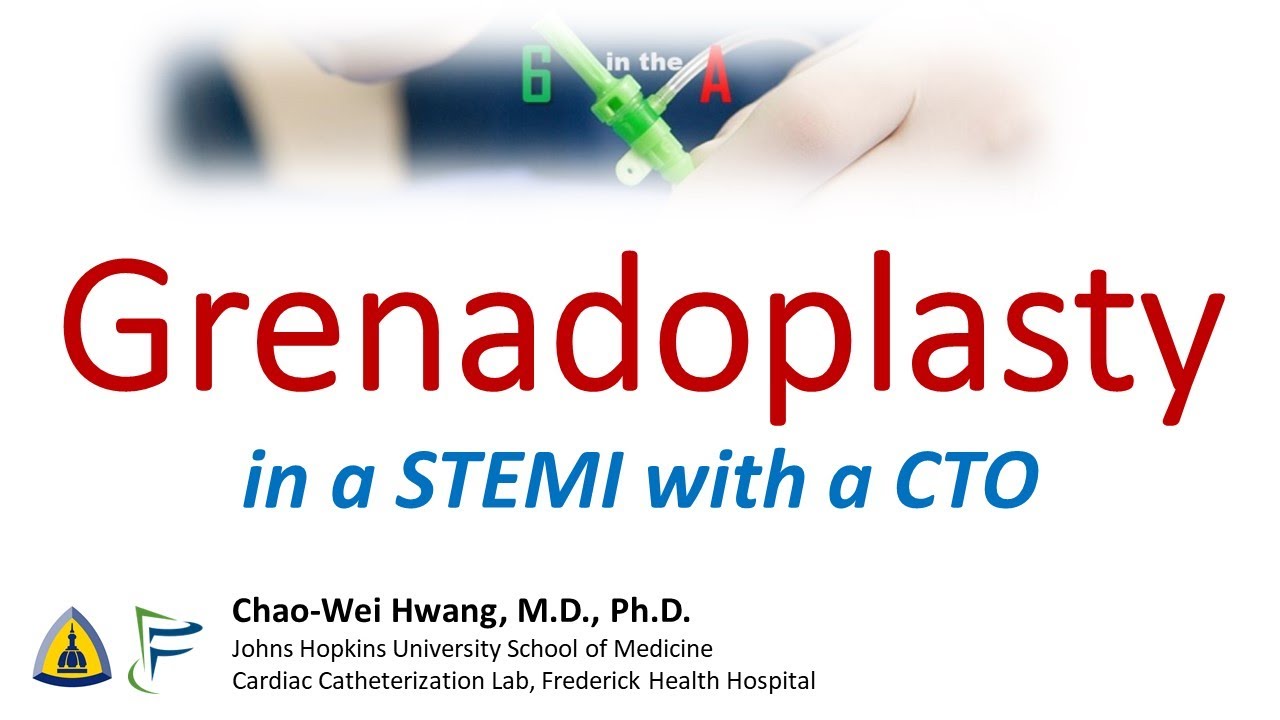 Grenadoplasty in a STEMI with a CTO