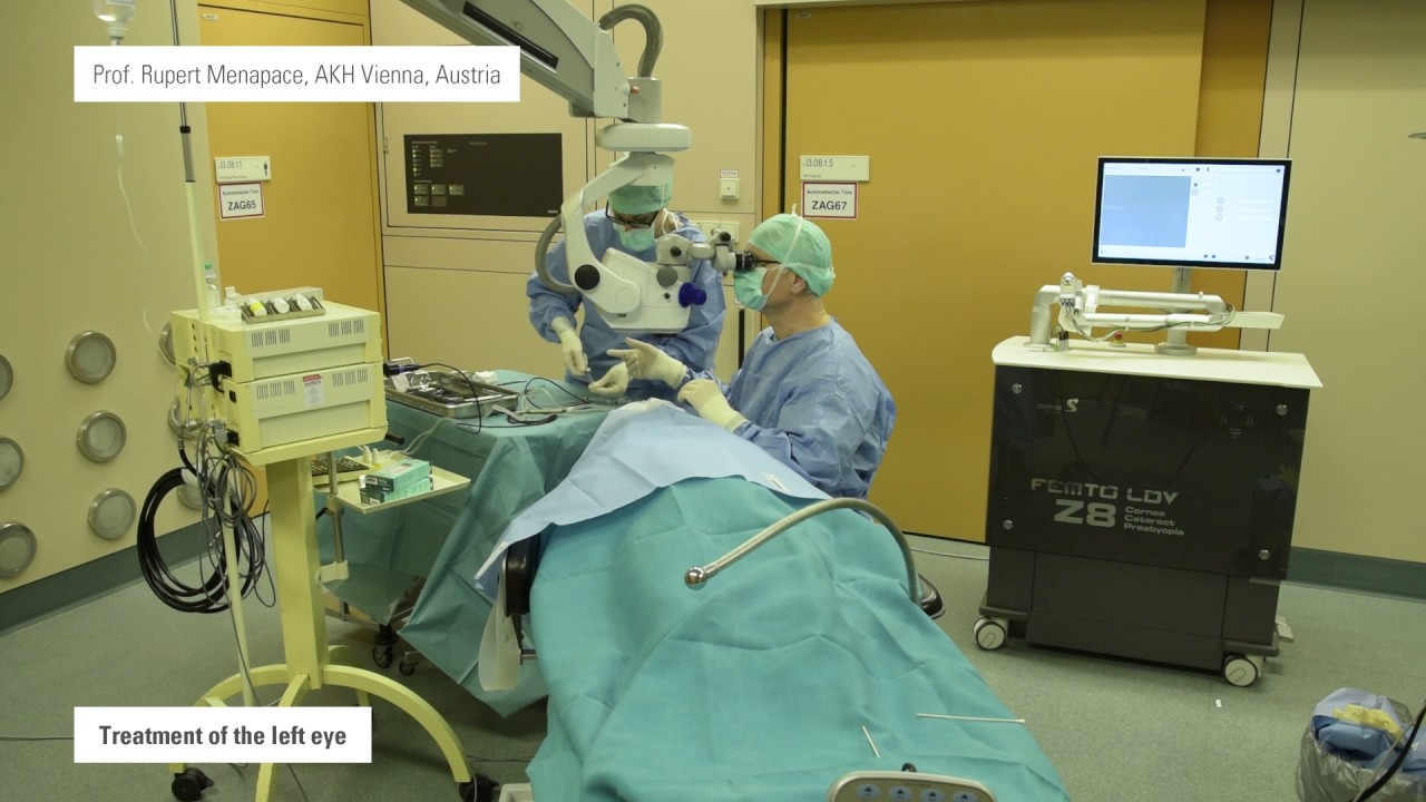 FEMTO LDV Z8 laser-assisted temporal ISBCS (Immediate sequential bilateral cataract surgery)
