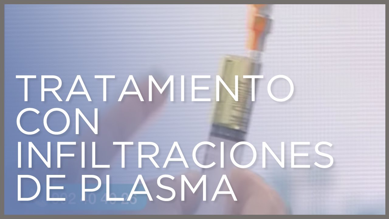 Tratamiento con infiltraciones de plasma rico en factores de crecimiento