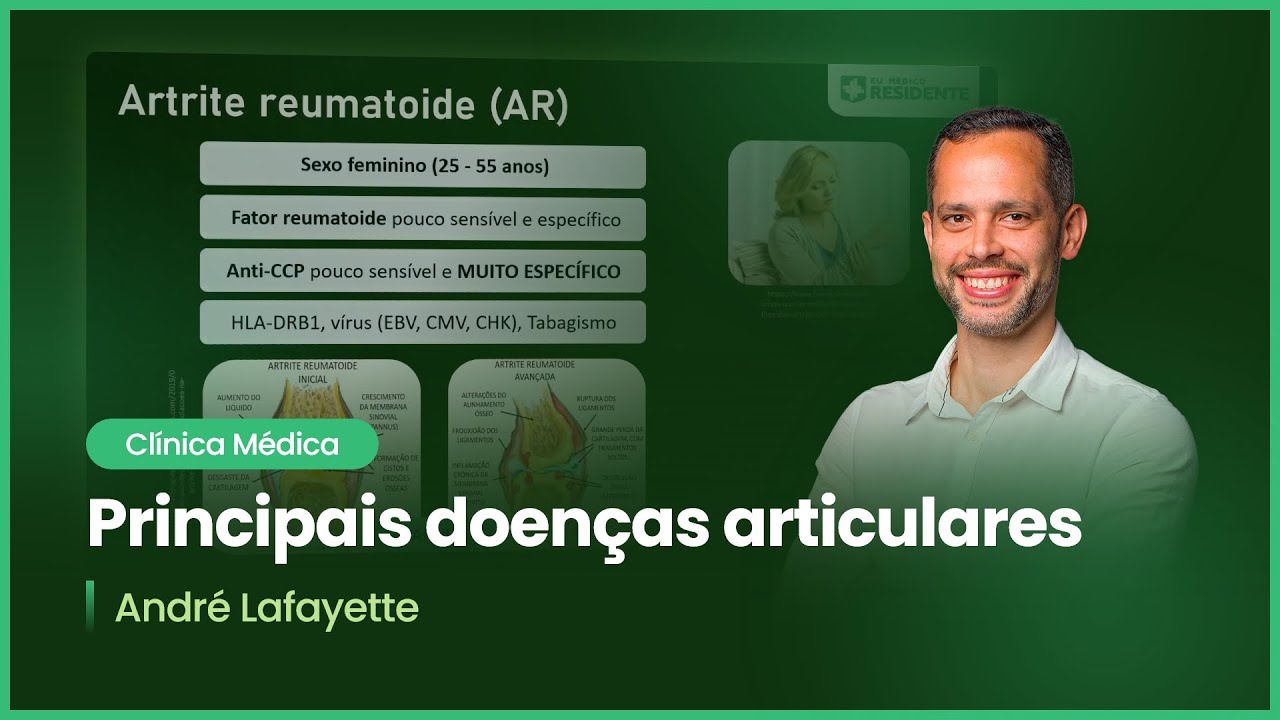 Principais doenças articulares | Cortes de Aulas: Clínica Médica