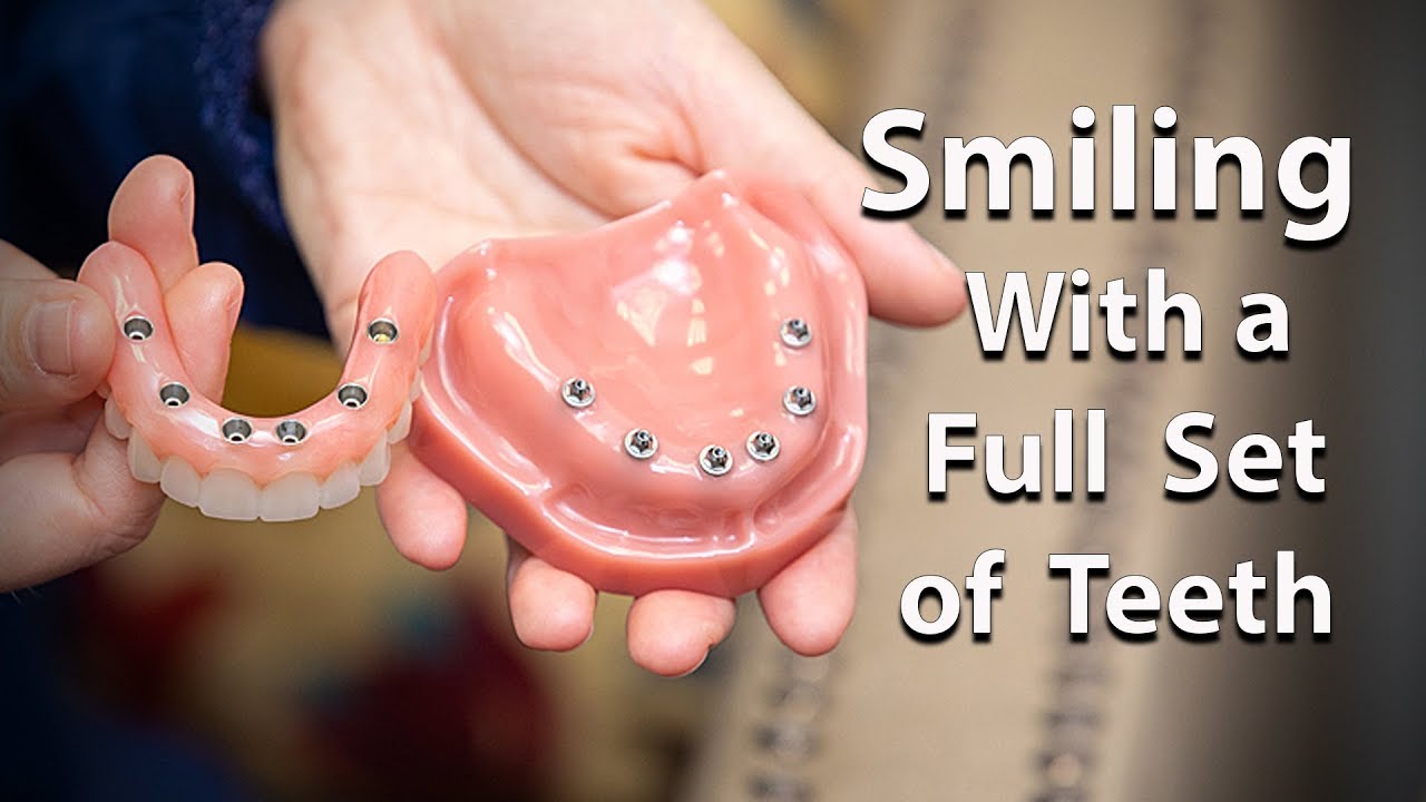 Missing Multiple Teeth? Consider full arch dental implants.