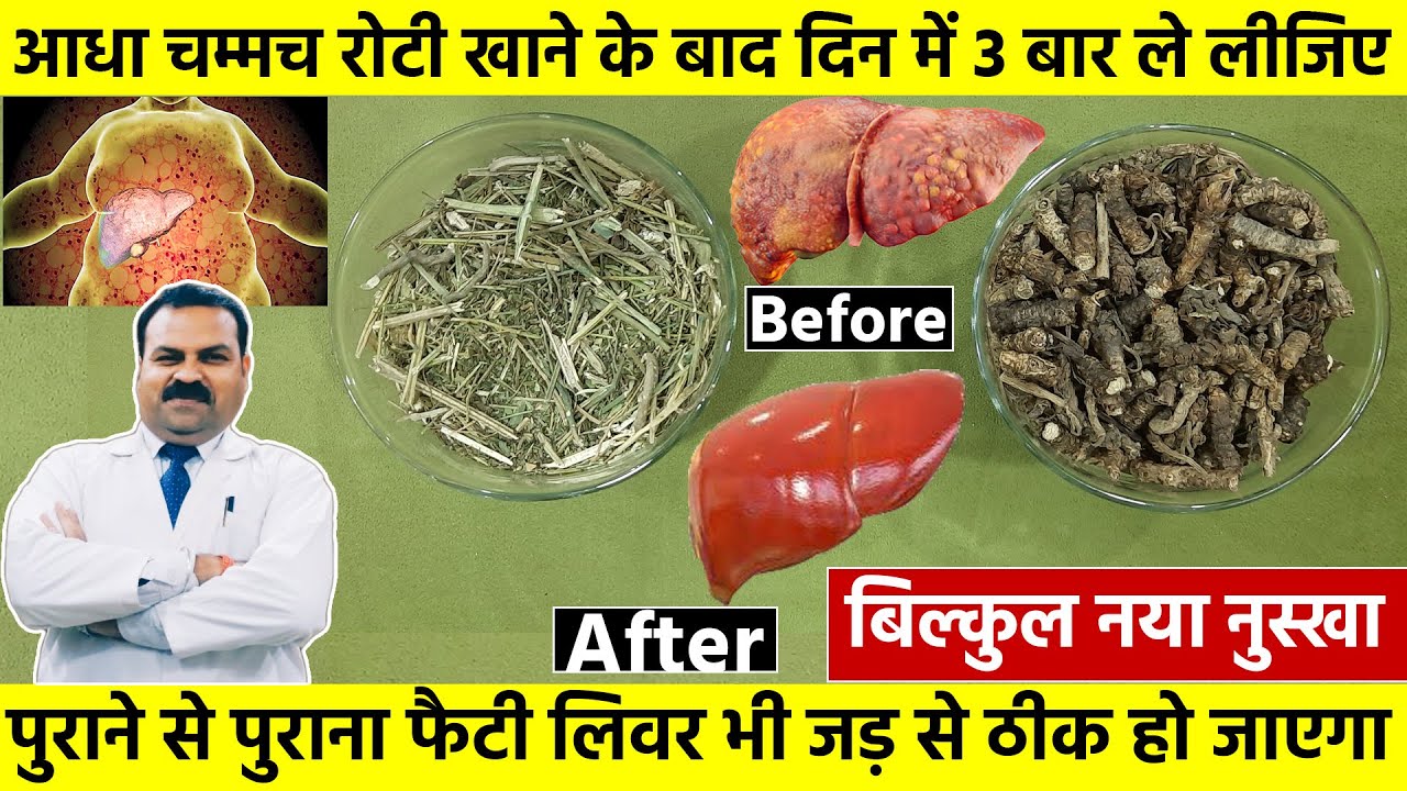 आधा चम्मच रोटी खाने के बाद दिन में 3 बार ले लीजिए पुराने से पुराना फैटी लीवर की जड़ से ठीक हो जाएगा