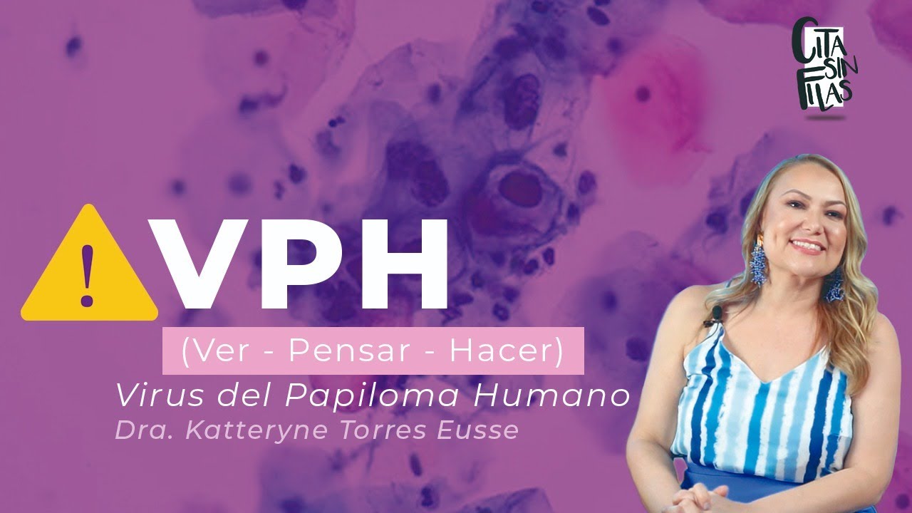 PUEDES MORIR POR CONTRAER VPH❓| Todo sobre el Virus del Papiloma Humano con la Dra. Katteryne Torres