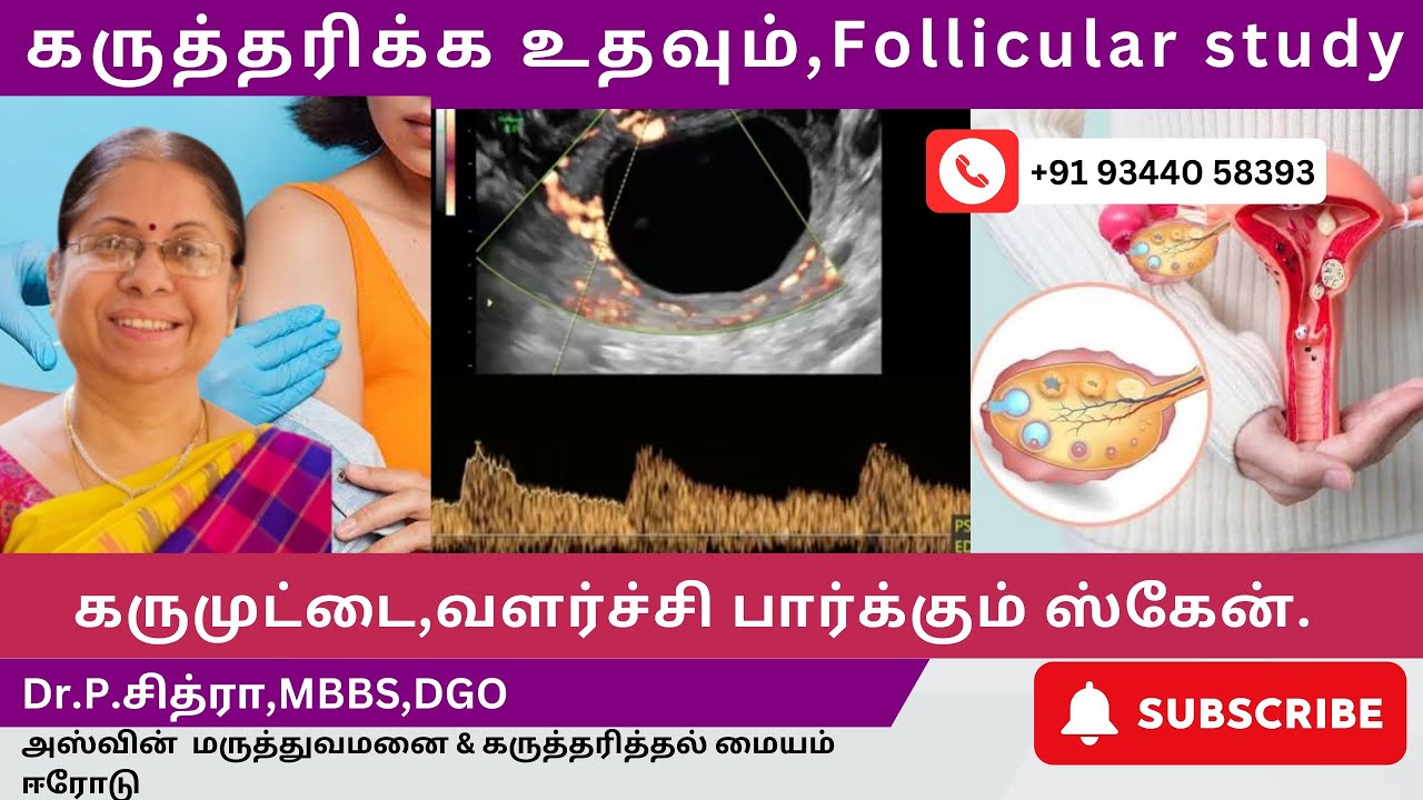 கருத்தரிக்க உதவும் Follicular Study Scan | கருமுட்டை, வளர்ச்சி பார்க்கும் Scan