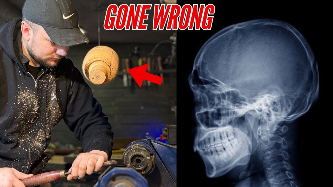 An Idiot with a Lathe Takes A Trip To The Emergency Room (GONE WRONG)