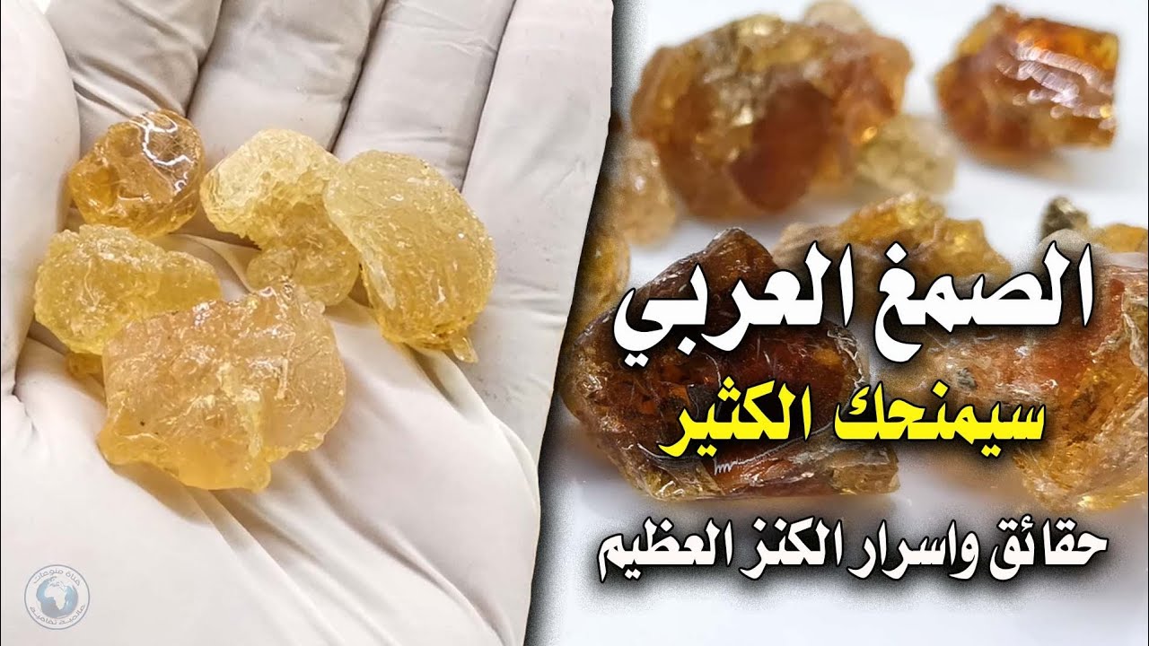 هذا ما سوف يحدث لجسمك بعد تناول الصمغ العربي حقائق واسرار- الكنز العظيم