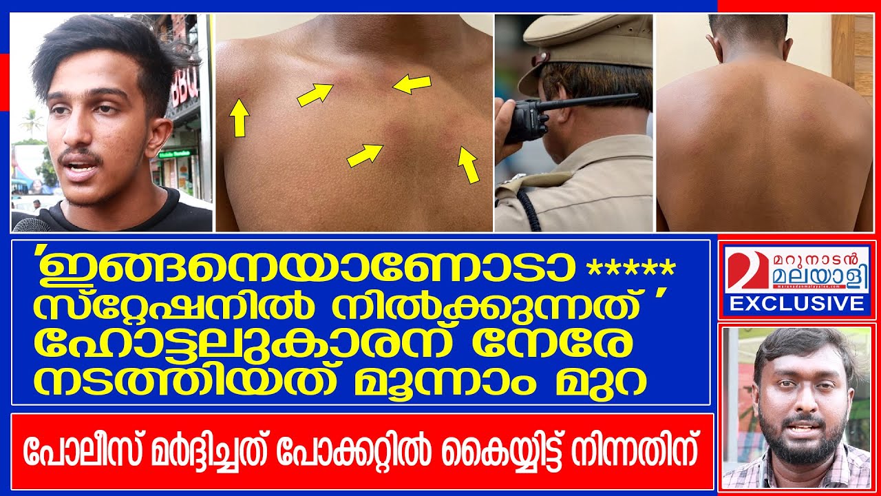 തൃപ്പുണിത്തുറ പോലീസ് മര്‍ദ്ദിച്ചത് പോക്കറ്റില്‍ കൈയ്യിട്ട് നിന്നതിന്  I   thrippunithura police