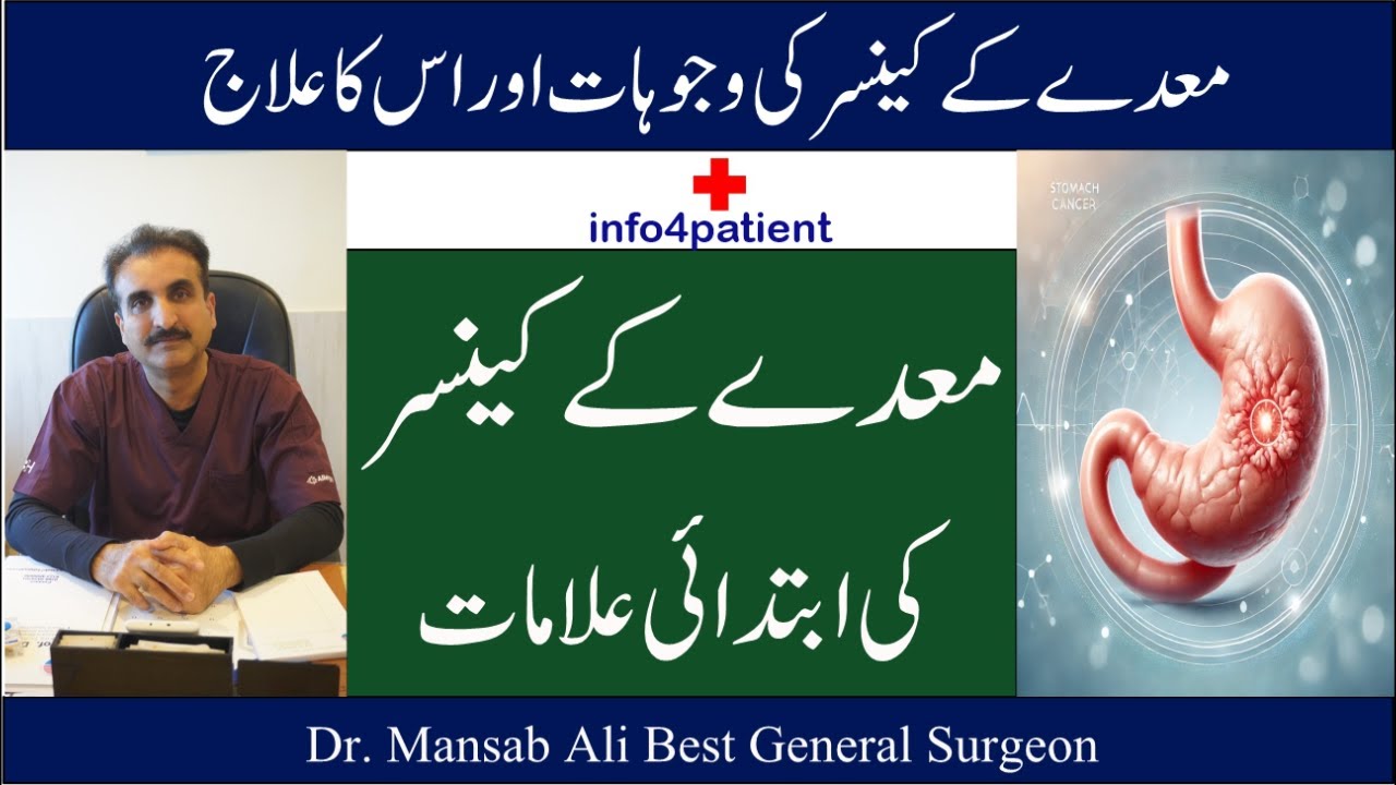 معدے کا کینسر: علامات اور علاج | Stomach Cancer Symptoms & Treatment | Dr. Mansab Ali