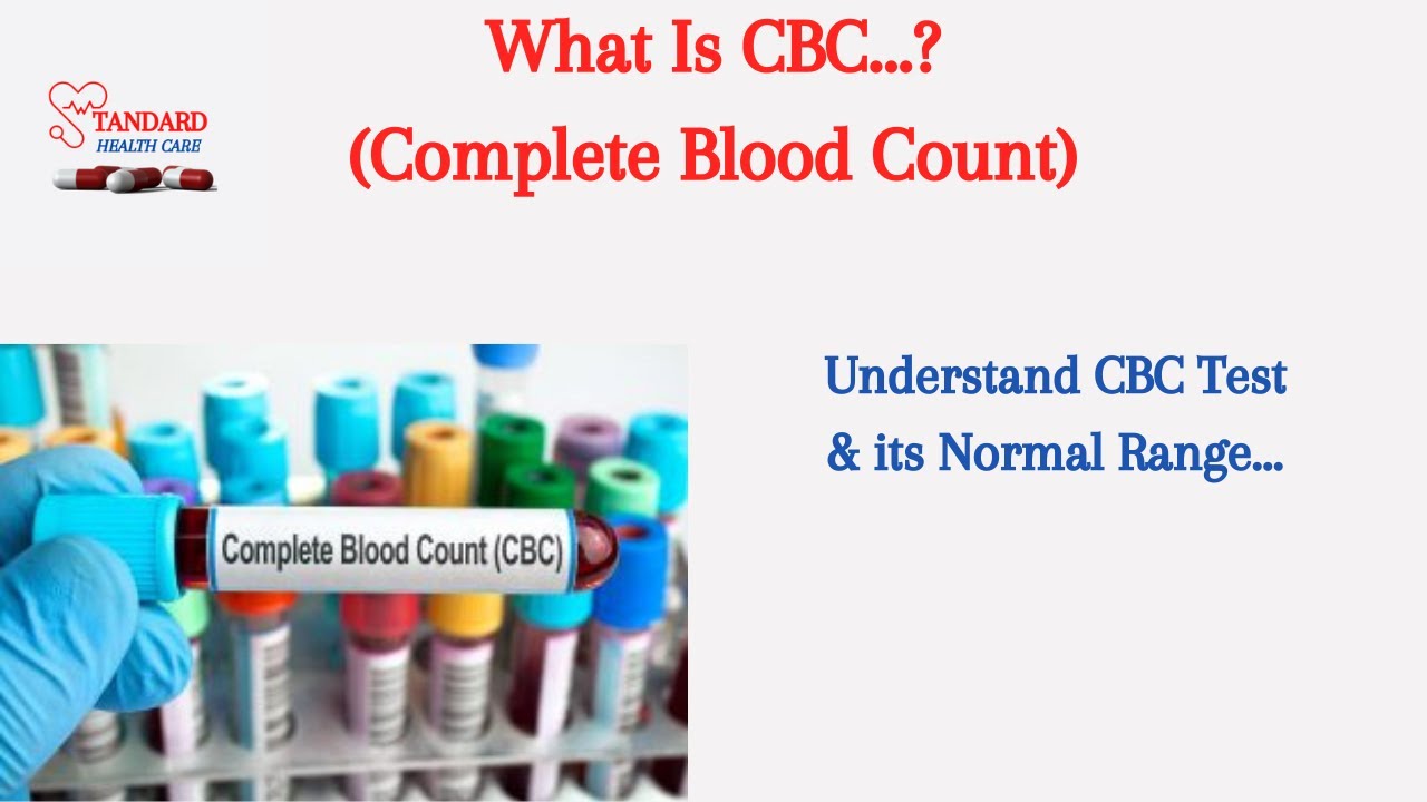 (CBC) Complete Blood Count Test Results Interpretation || Normal Ranges || How To Read Your CBC/URDU