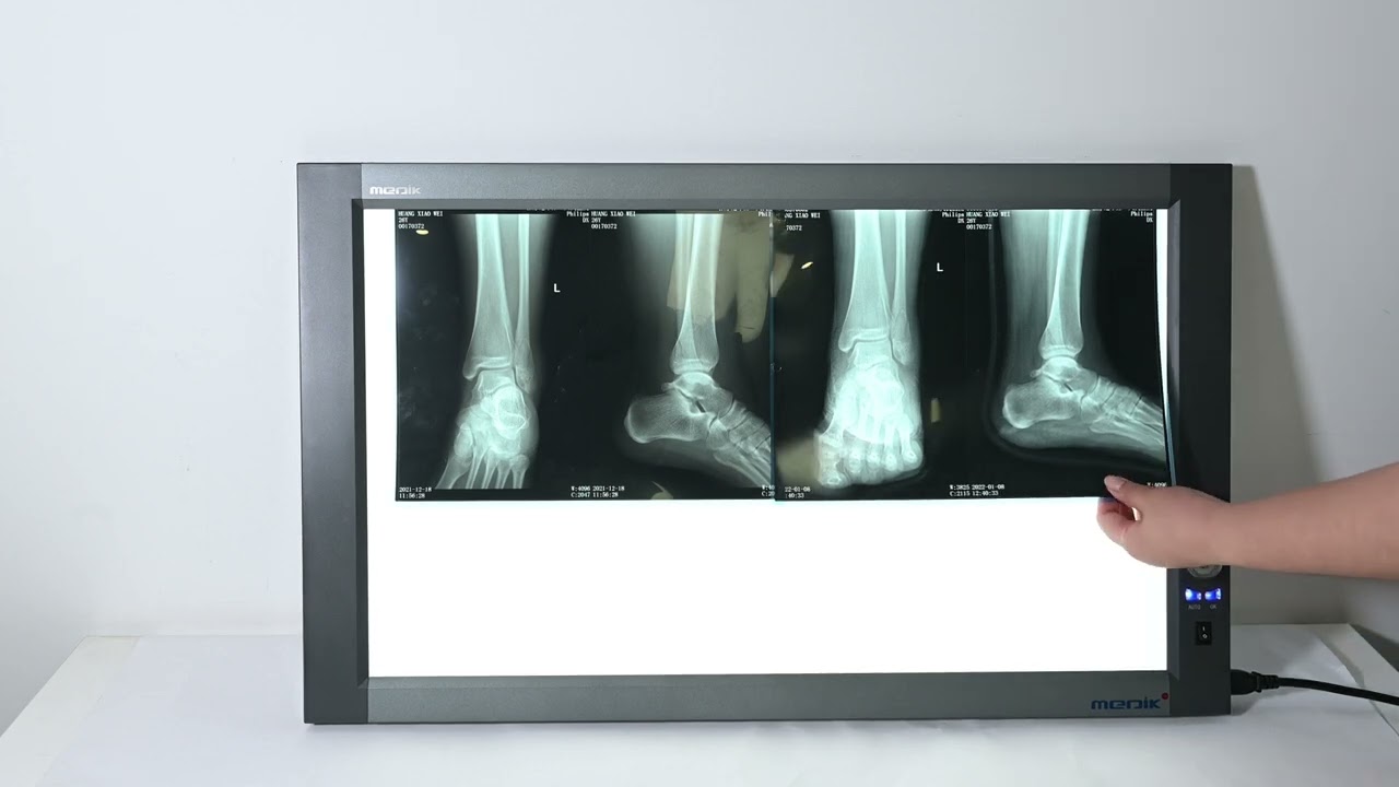 YA-NS02 Double-panel Led X-ray film viewer