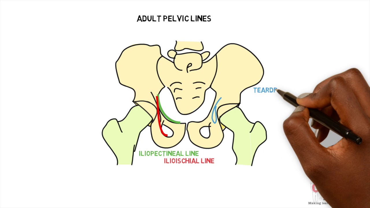 Radiographic features - Adult pelvic lines