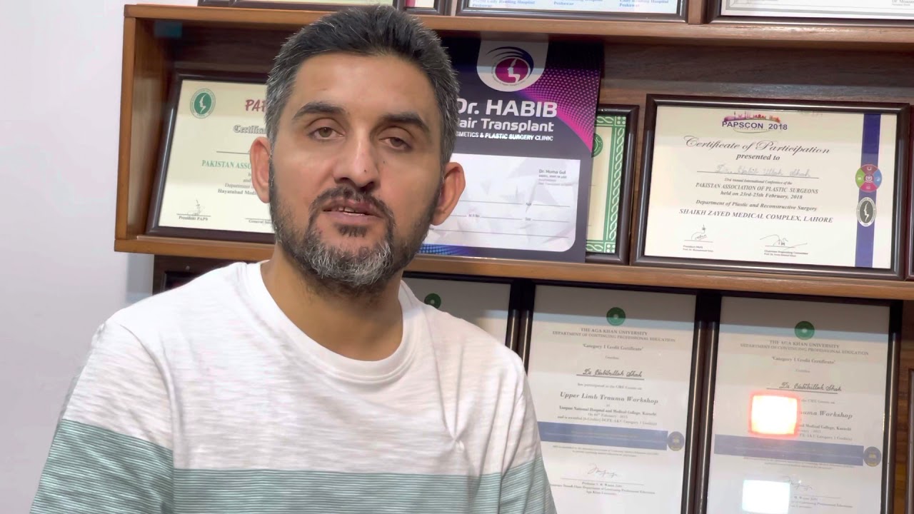 Hair loss due to dandruff permanent or temporary?