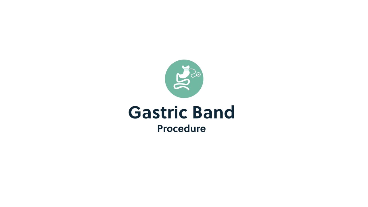 Gastric Band Surgery FAQs with Bariatric Surgeon Sherif Awad