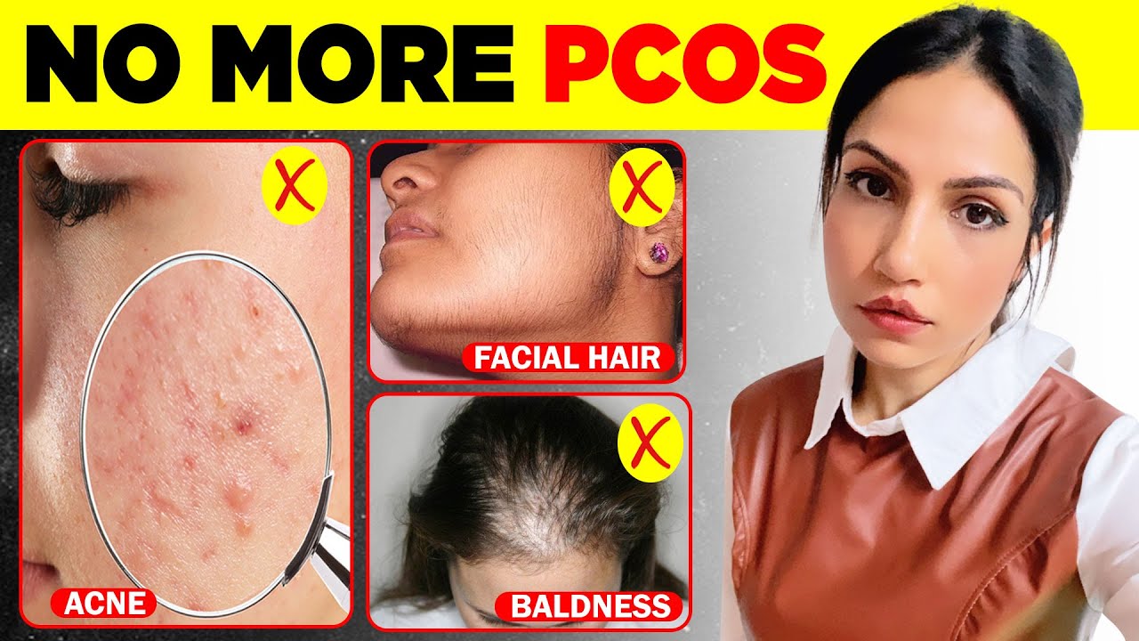 PCOS/PCOD | Polycystic Ovary Syndrome Signs & Symptoms | PCOS/PCOD के लक्षण को जड़ से खत्म करे