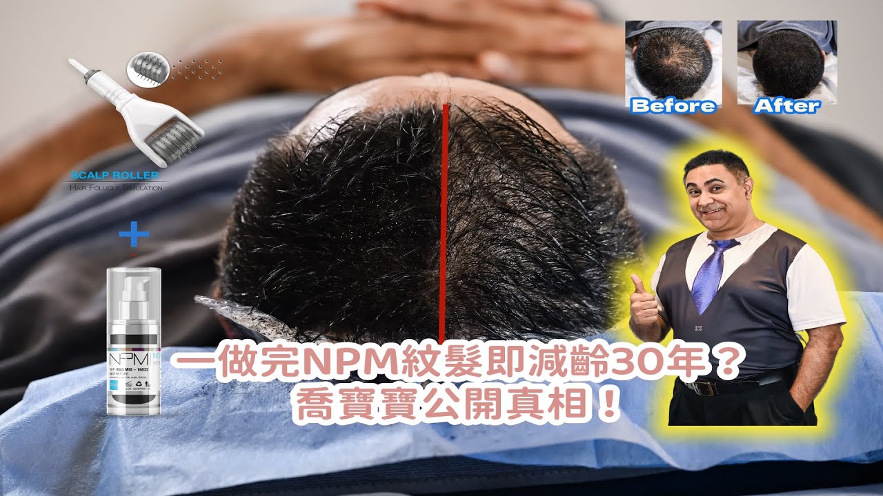 NPM紋髮不只紋髮際線！喬寶寶親身示範｜香港紋髮TOP 1 紋髮技術大公開！