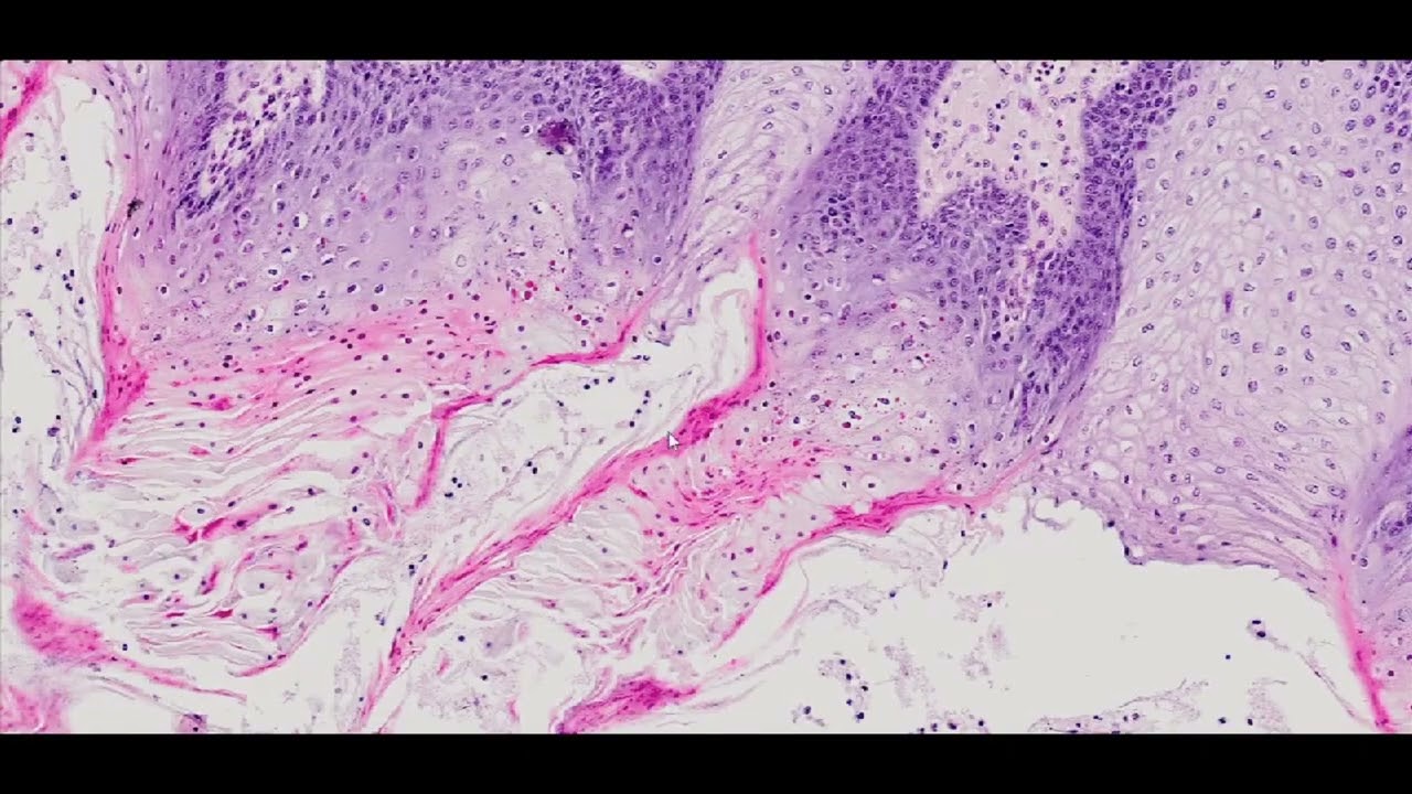 The tongue with filiform and circumvallate papillae - PUMS Histology Slides Review Series