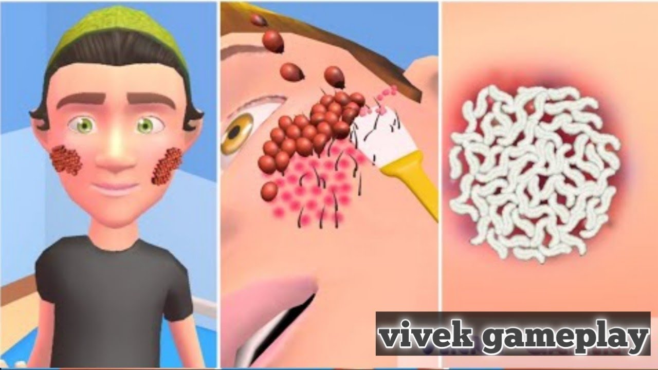 Parasite Cleaner - New Levels |All Levels Gameplay Trailer Android, iOS PC1GP30 @kahaniya_desi