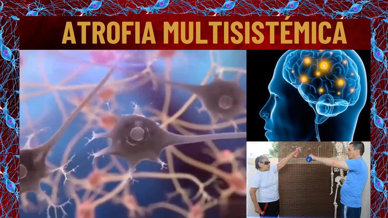 Atrofia multisistémica