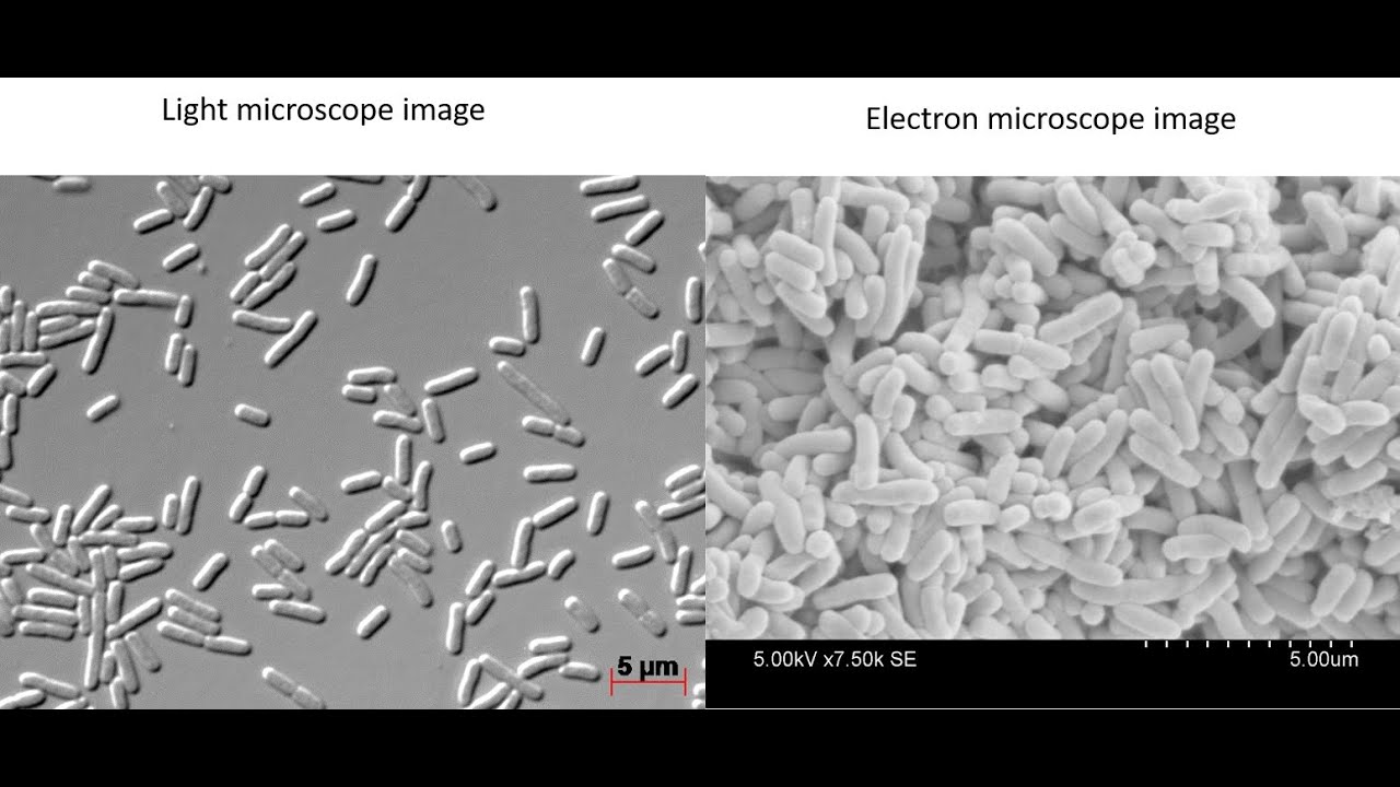 What do bacteria look like under a light vs electron microscope?