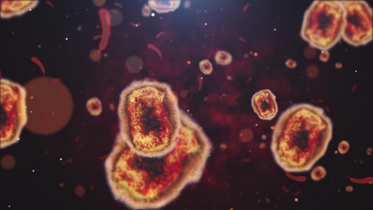 First monkeypox related death reported in Indiana