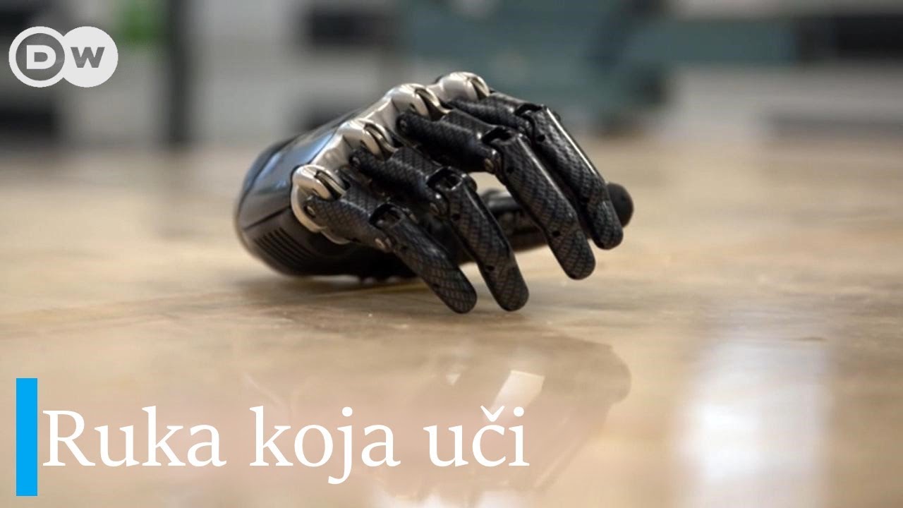 „Pametna“ proteza vraća kvalitet života