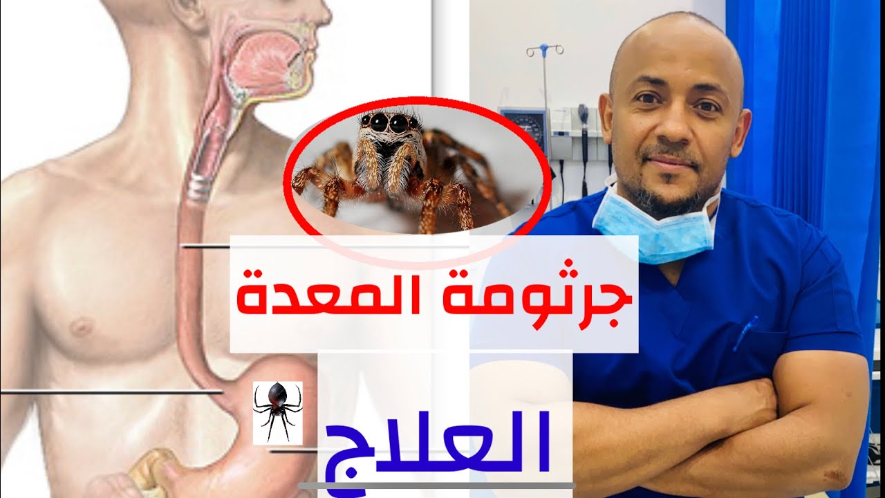 علاج جرثومة المعدة و التهاب المعدة من المنزل/ اعراض جرثومة المعدة و العلاج/ التشخيص/