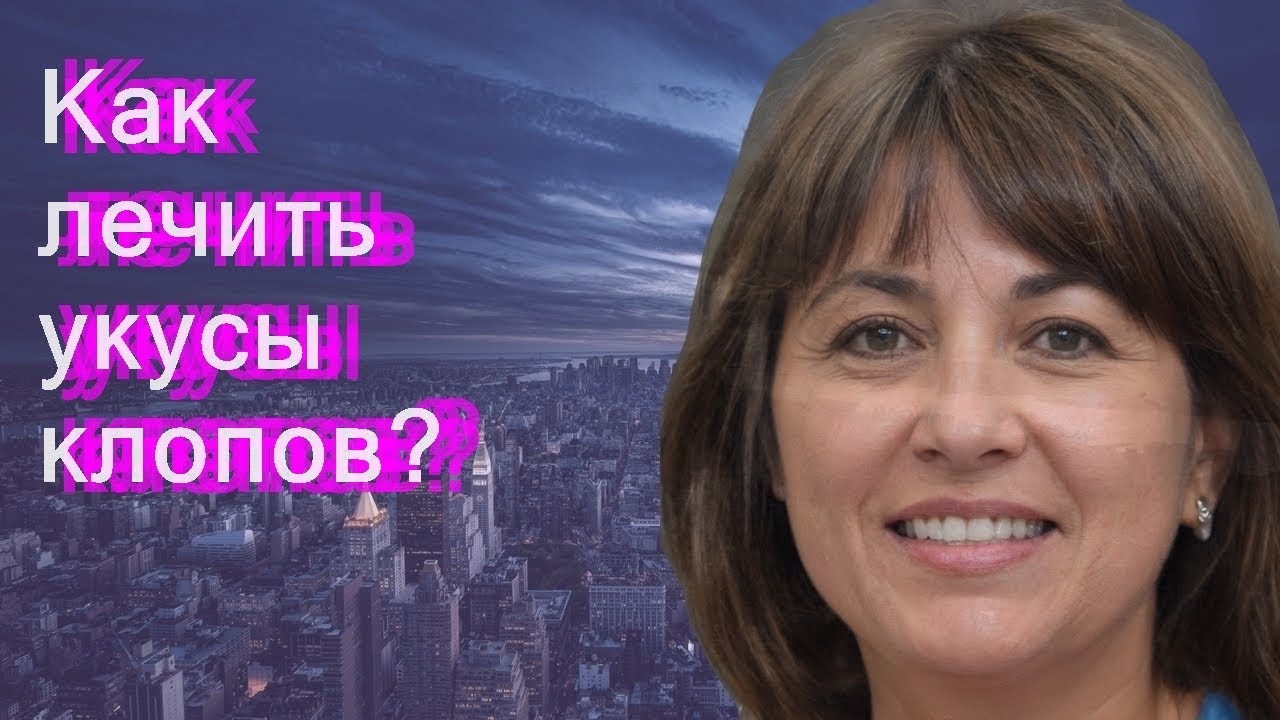 Как лечить укусы клопов?