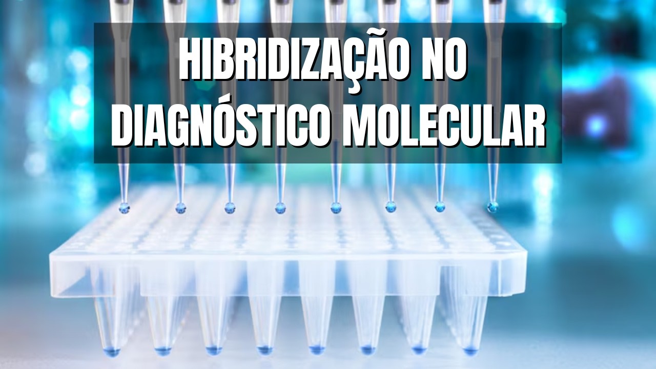 DIAGNÓSTICO MOLECULAR e Técnicas de HIBRIDIZAÇÃO - Analisando DNA e RNA