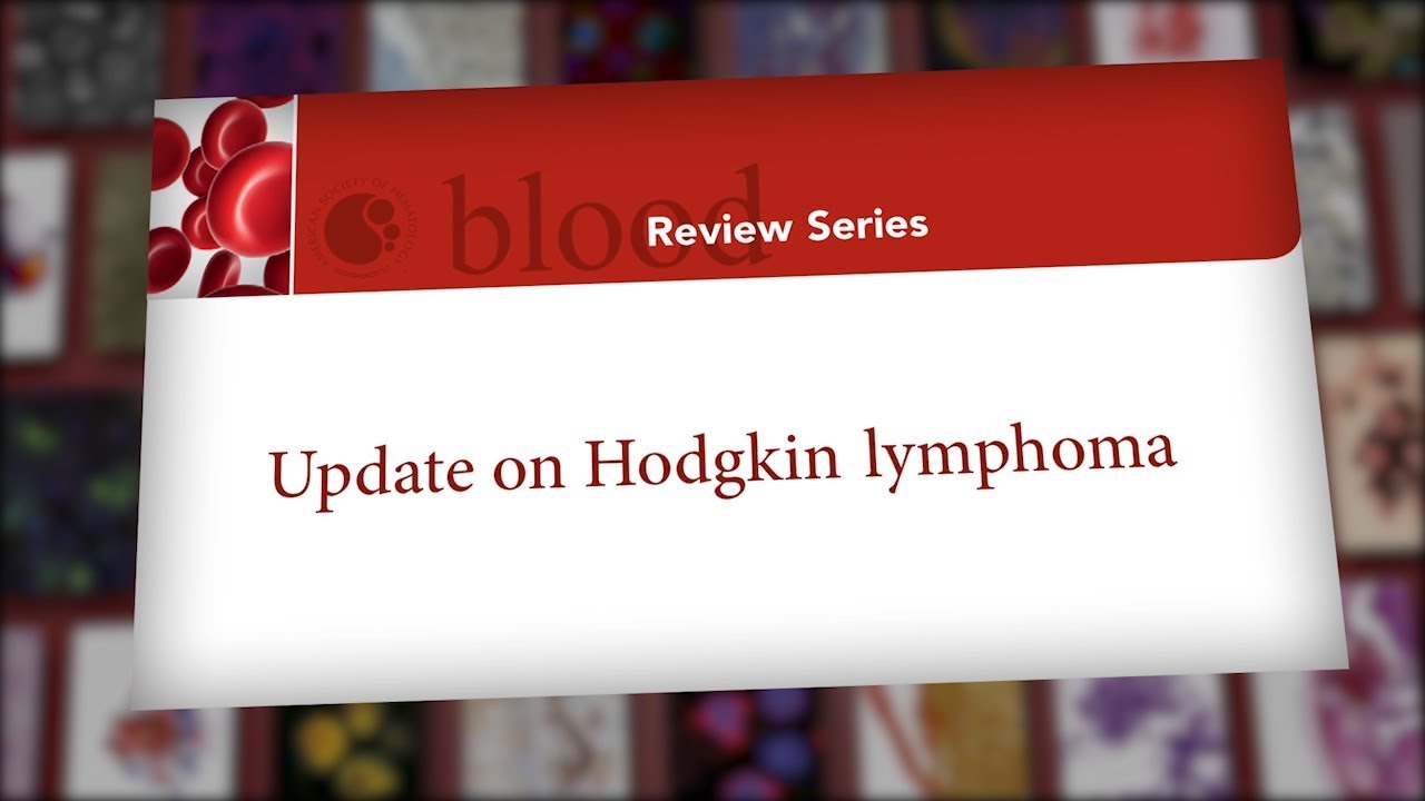 Blood Review Series &ndash; Update on Hodgkin Lymphoma