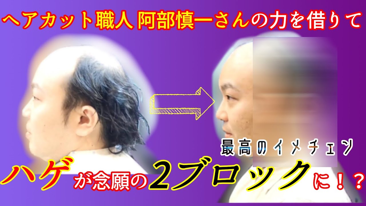 【ヘアカット】【ハゲ】落武者ヘアから夢の2ブロックに！プロの力で、最高のイメチェンが出来ました！　※動画の最後に二人芝居のCM付きです。