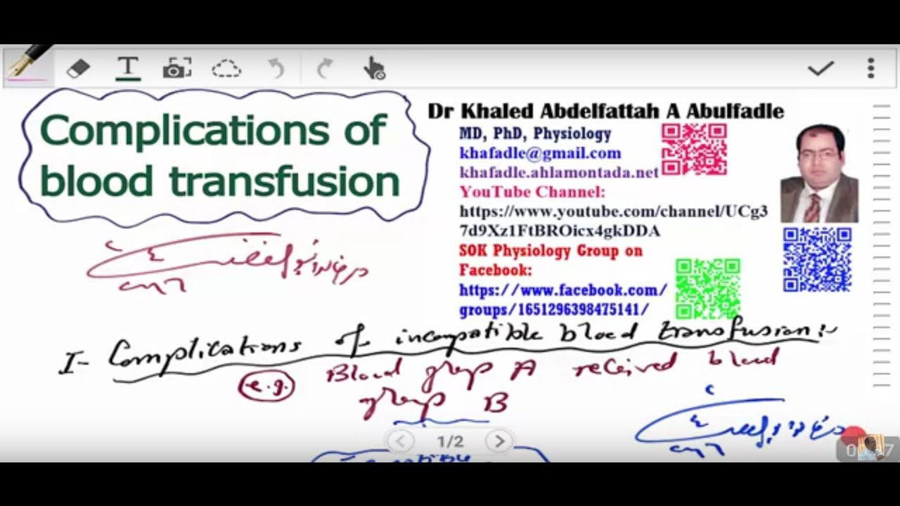 Complications of blood transfusion (4-2016) by Dr Khaled A Abulfadle