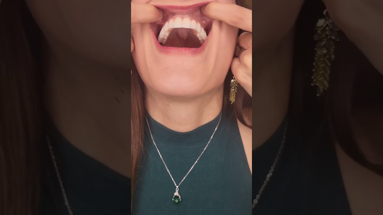 Dental Implants UP CLOSE! #teeth #dentalimplants